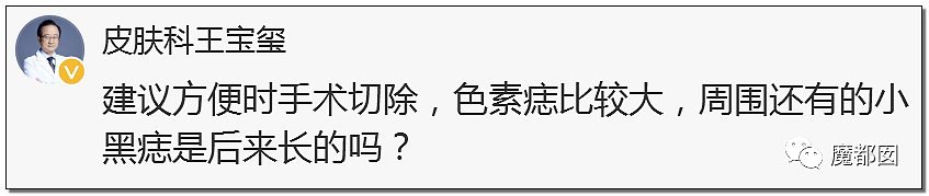 全网热议！赶紧看看你脚底和手上有无黑痣，可能会要命！（组图） - 61