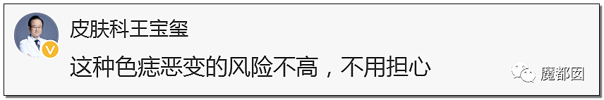 全网热议！赶紧看看你脚底和手上有无黑痣，可能会要命！（组图） - 67