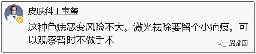 全网热议！赶紧看看你脚底和手上有无黑痣，可能会要命！（组图） - 71