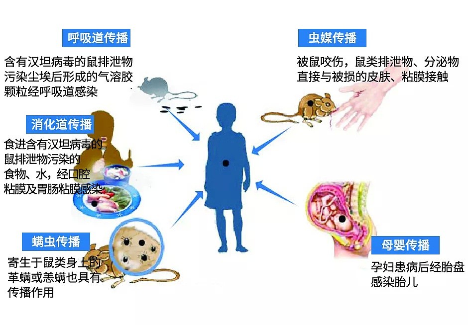 喝完一罐饮料，中国男子感染病毒反复高烧，严重肾衰竭！紧急提醒：这个习惯赶紧改（组图） - 4