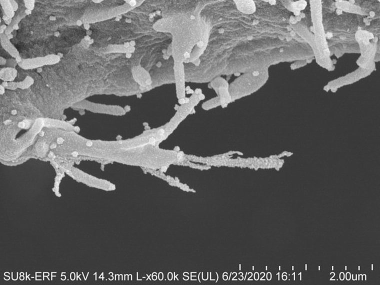 电子显微镜下的惊人照片：新冠病毒伸出“触手”注射毒液…（组图） - 2