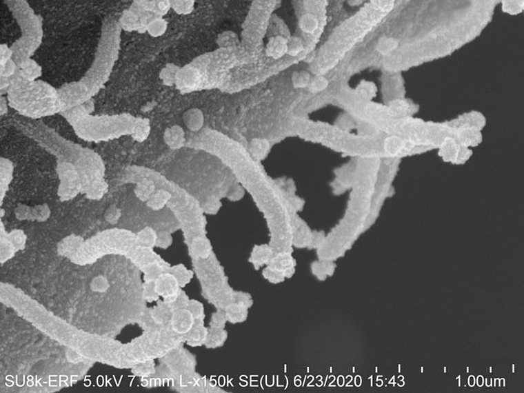 电子显微镜下的惊人照片：新冠病毒伸出“触手”注射毒液…（组图） - 3