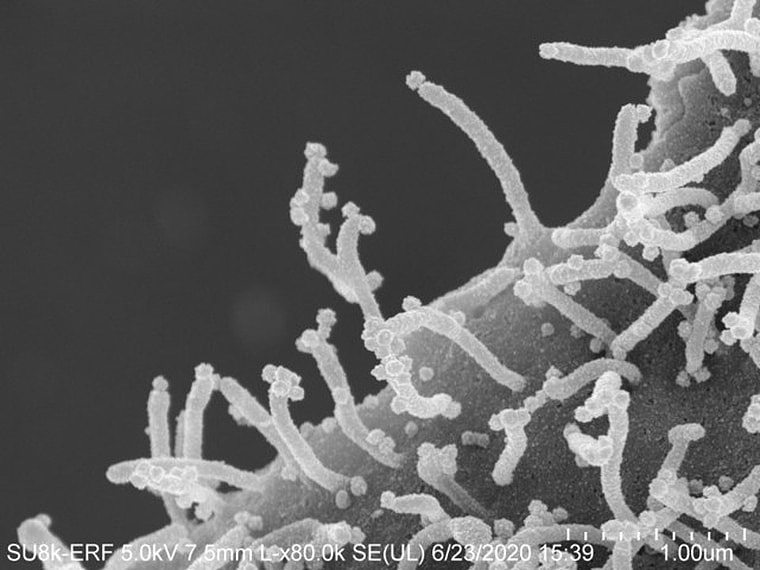 电子显微镜下的惊人照片：新冠病毒伸出“触手”注射毒液…（组图） - 4