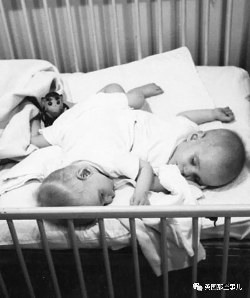 世界最长寿的连体男双胞胎去世了，曾被当成怪物展出，一生却毫无遗憾 - 3