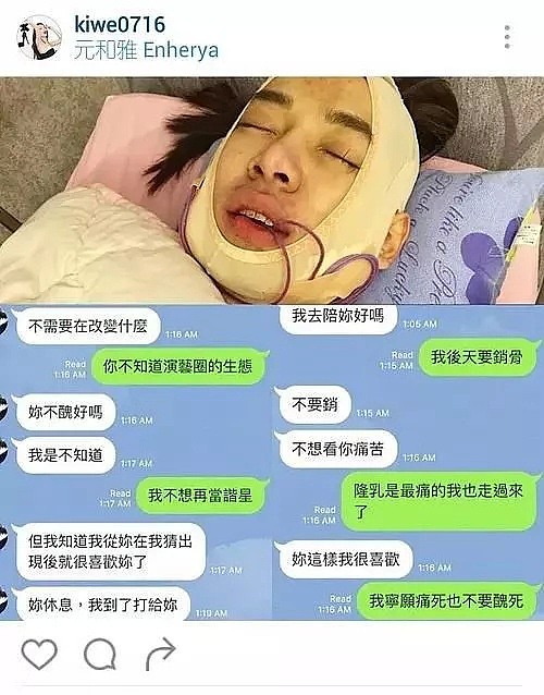 只想勾引男人？甚至以“男儿身”去隆胸，撞脸Angelababy，宁愿痛死也不要丑死！（组图） - 11