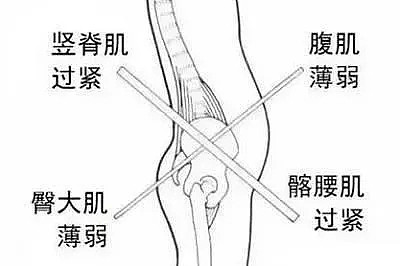 “假翘臀”，毁了多少健身女孩？（组图） - 22