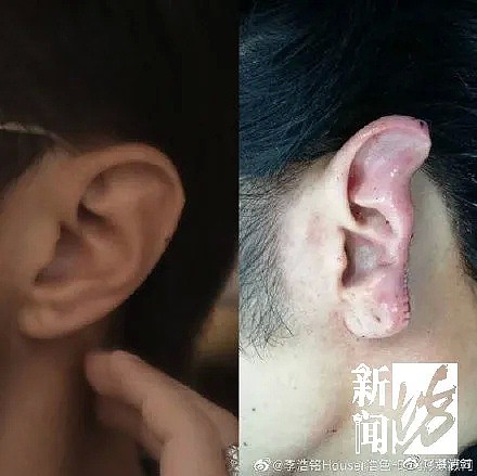 光天化日，竟有人当街非礼女性！上海一小伙见义勇为，被咬掉近半个耳朵…（组图） - 6
