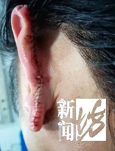 光天化日，竟有人当街非礼女性！上海一小伙见义勇为，被咬掉近半个耳朵…（组图） - 7
