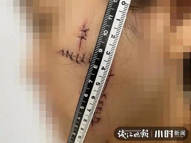 “毁容了我也不嫌弃你！”男子带前女友到墓地…真相让人愤怒（组图） - 2