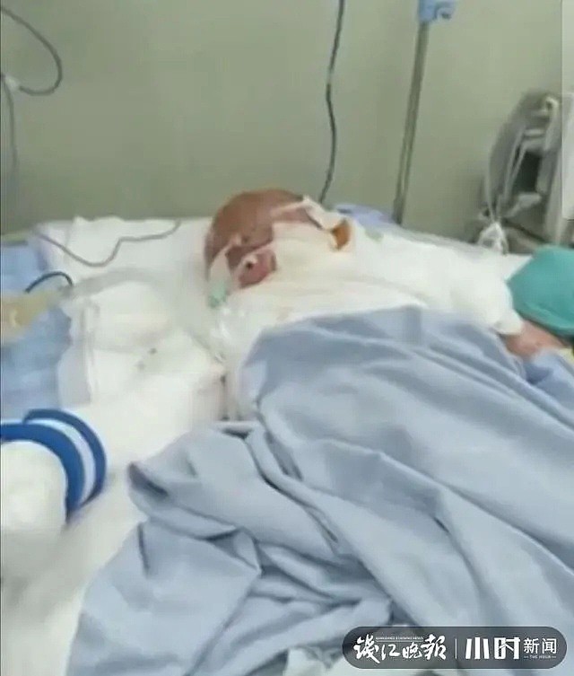 培训班里做网红实验，中国6个孩子烧伤！1个还躺进了ICU…（视频/图） - 1