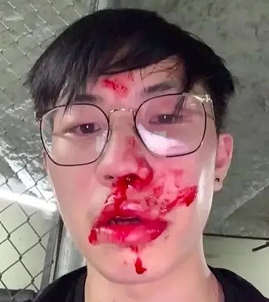 华人小哥遭加拿大边境局官员暴打血流满面！还被辱骂“滚回你的国家”（组图） - 8
