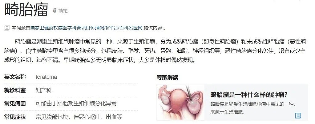 惊悚！25岁中国名校女研究生突然学动物叫？起因竟是卵巢长出脑组织（组图） - 5