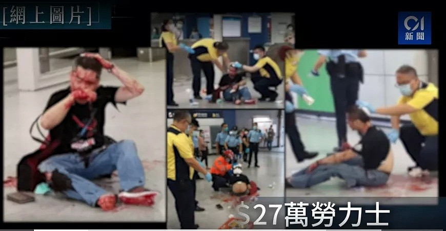 澳华男回国避疫滞留香港，遭歹徒当众狂砍！27万名表被抢，现场无人施救（视频/组图） - 1