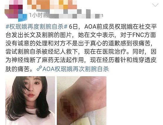 26岁韩国女偶像再度割腕，伤口曝光狰狞吓人，公司回应已在家休息（组图） - 1