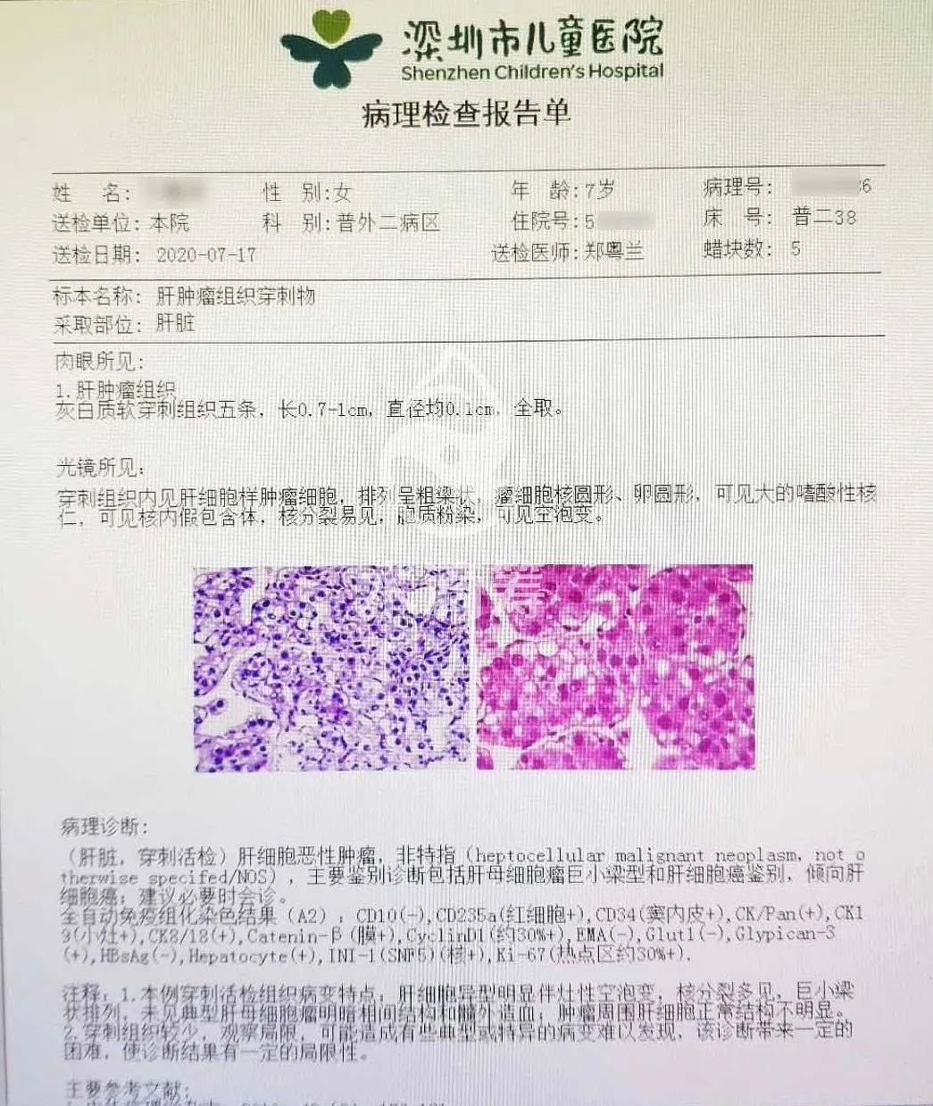 心痛！7岁女孩肚子疼，一查已是癌症晚期，祸根在出生时就埋下（组图） - 2