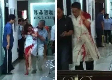 中国一对夫妻带孩子去美国看病, 却被美国警察用枪托把其手臂砸断！警察竟获得大量支持（组图） - 1