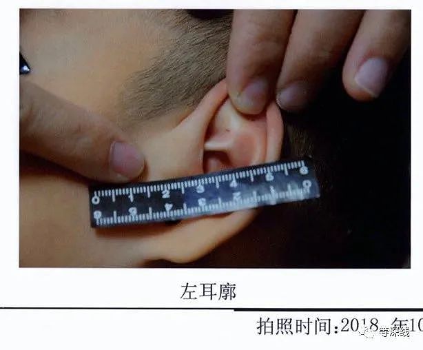 天津37名儿童被针扎虐待：老师用大头针图钉扎，还说“挺管用（组图） - 2