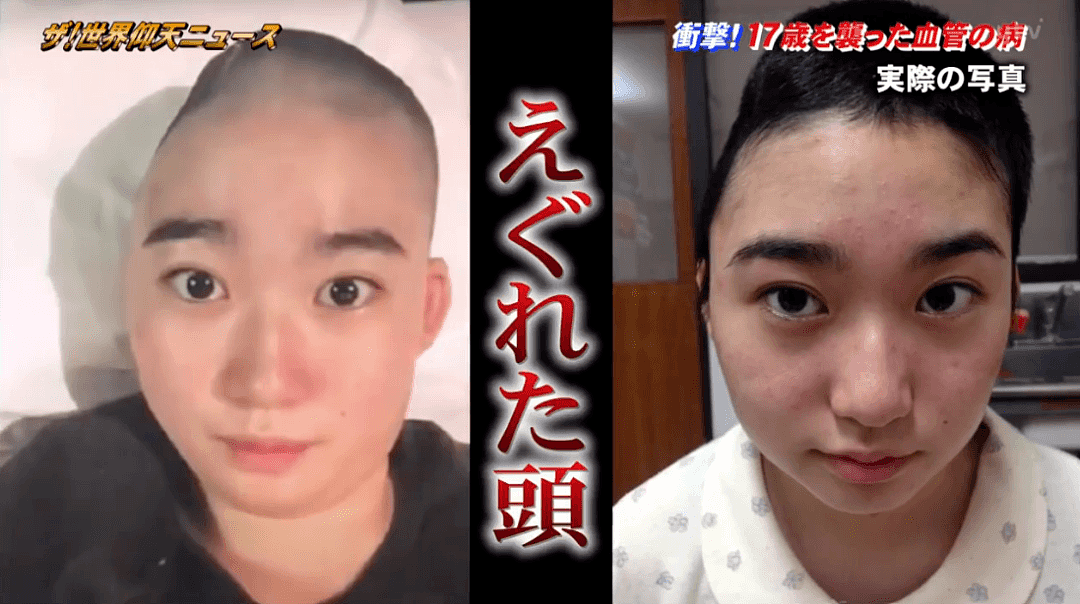 日本美少女17岁时切掉15cm头骨，半边身体无知觉，如今却成为了网红模特（组图） - 20