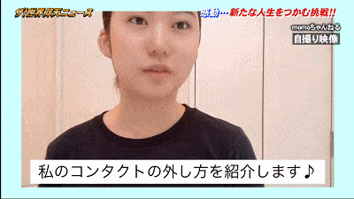 日本美少女17岁时切掉15cm头骨，半边身体无知觉，如今却成为了网红模特（组图） - 31
