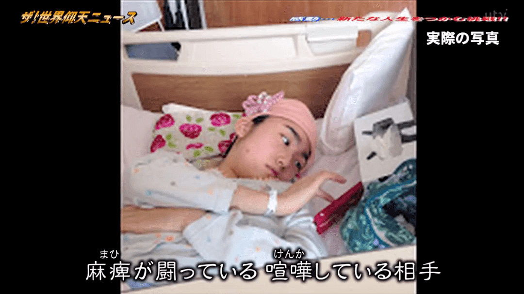 日本美少女17岁时切掉15cm头骨，半边身体无知觉，如今却成为了网红模特（组图） - 34