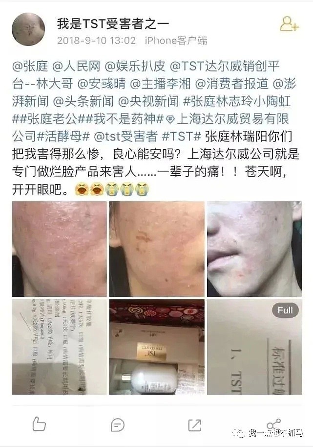 张庭逼宫原配，洗白成“恩爱典范”？生男孩做9次试管、为渣男下海捞金，她到底图什么？（组图） - 43