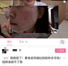 120万人围观女孩被暴食症折磨 网友怒槽：和猪有什么区别（组图） - 9