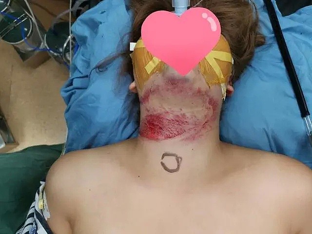 飞来横祸！中国24岁姑娘骑电动车惨遭“割喉”，罪魁祸首万万没想到是这个（视频/组图） - 2