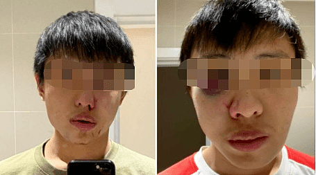 因新冠围殴亚裔留学生的嫌疑人认罪，是15岁未成年！在海外华人如何应对种族歧视？（组图） - 3