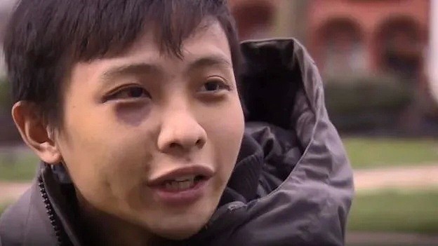 因新冠围殴亚裔留学生的嫌疑人认罪，是15岁未成年！在海外华人如何应对种族歧视？（组图） - 4
