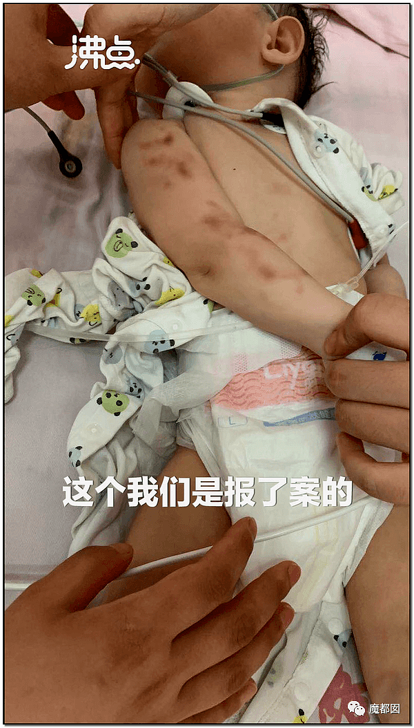 视频曝光！中国男子残忍摔打幼童致死激起全网公愤，母亲一旁拍摄未阻止，律师：拍摄者如有意配合或构成共犯（视频/组图） - 25