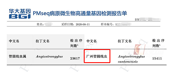 可怕！中国26岁小伙脑中布满虫子，大小便失禁…只因平常喜欢喝这种水（组图） - 4