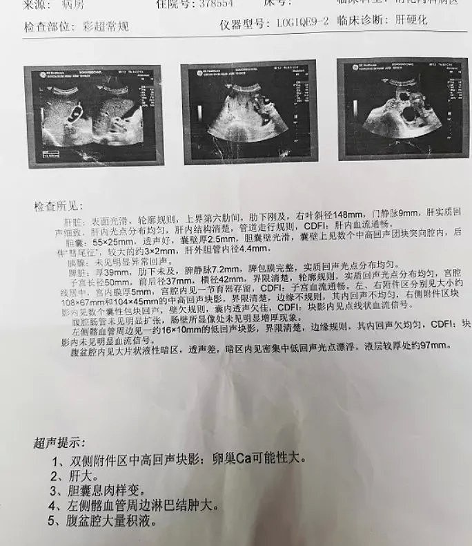 恐怖！2年时间中国妈妈肚子疯长成巨球，每晚只能坐着睡觉…全靠10岁儿子支援家庭（组图） - 4