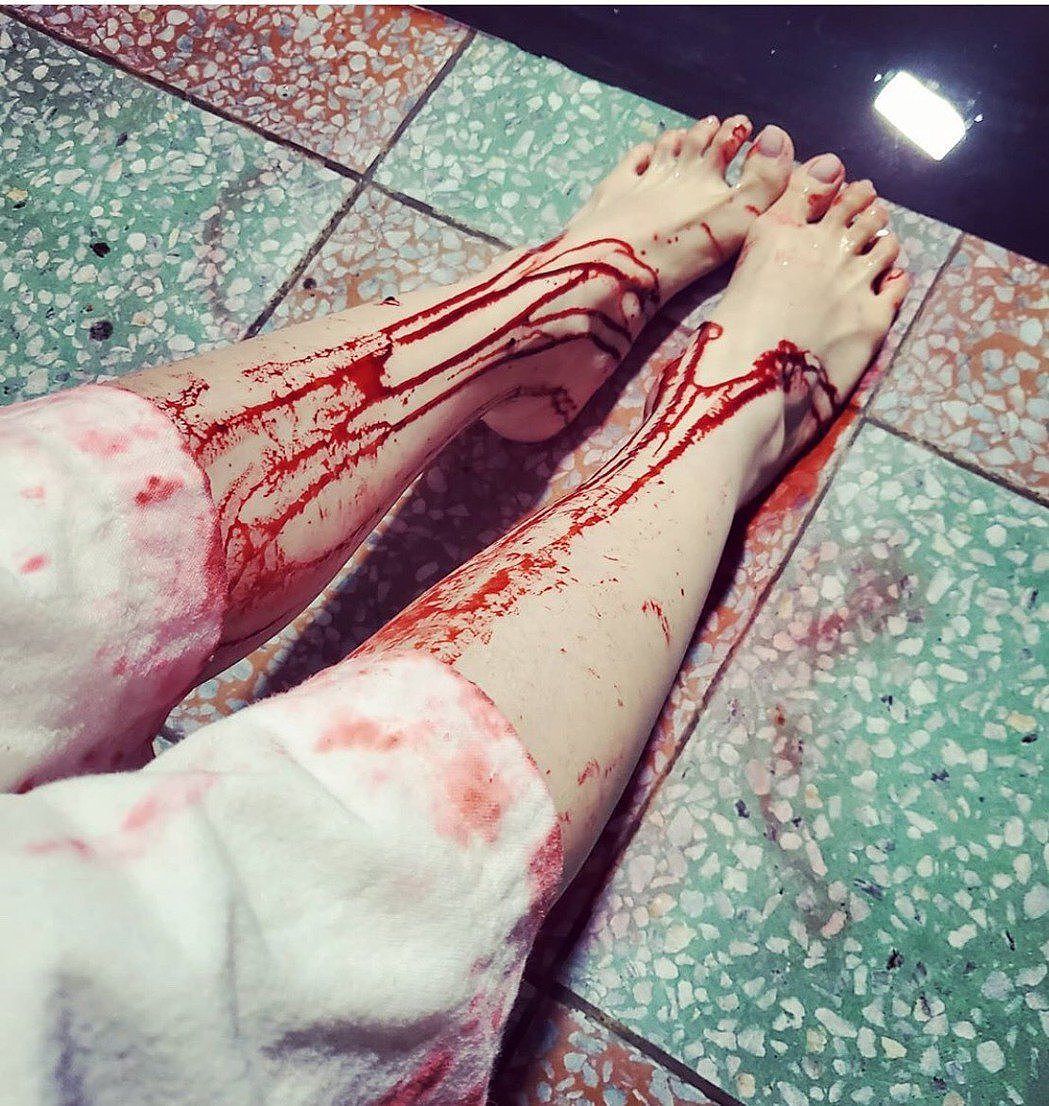 蔡依林深夜突上传一张双腿血流成河的照片，吓坏无数粉丝。 图：翻摄自蔡依林IG