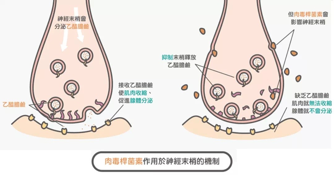 講師級醫生為你講解，為什麼你打了肉毒，臉卻不瘦？ - 5