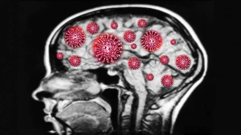 耶鲁最新研究：新冠病毒可“劫持”脑细胞并自我复制（图） - 1
