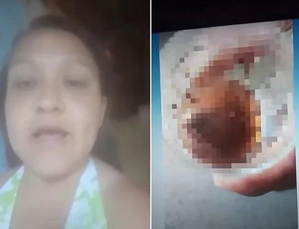 巴西一名女子咬下前男友的睾丸。 翻摄自YouTube