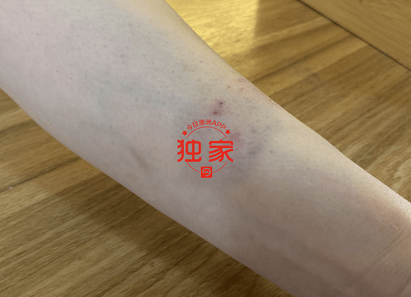 悉尼中国女留学生与华人女店主当街扭打，双双受伤！只因两份配菜起争执，店内外视频全拍下（视频/组图） - 8