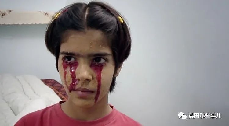 巴西15岁少女莫名双眼流血…这古老神秘的