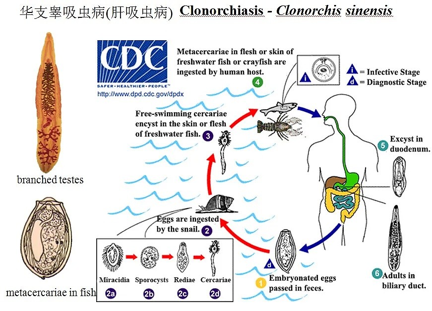 男子左肝被掏空，布满密密麻麻的虫卵，只因吃了这个…澳洲随处可见，很多华人都爱吃！ - 13