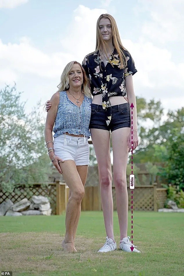 腿长1米35！美17岁少女打破世界纪录，逆天长腿占身高60%（组图） - 1