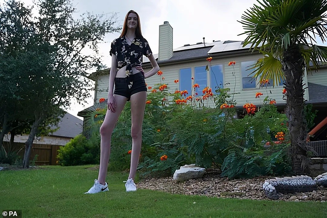 腿长1米35！美17岁少女打破世界纪录，逆天长腿占身高60%（组图） - 2
