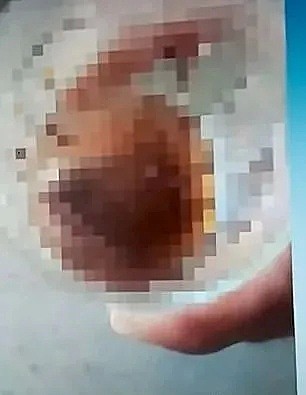 巴西女子遭前男友性侵，挣扎中咬掉了他的蛋蛋...（组图） - 6