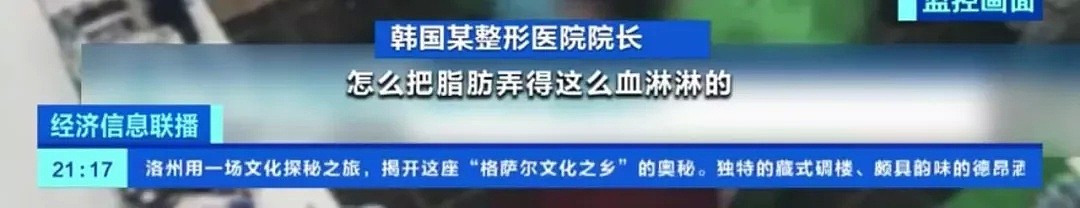 香港豪门千金隆胸死亡，丈夫索赔上亿：那些被整形毁容的年轻女性们（组图） - 10