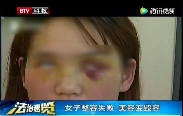 香港名媛整容身亡，背后黑幕被深扒：暗访视频曝光后，我看到了最恐怖的一幕（组图） - 33