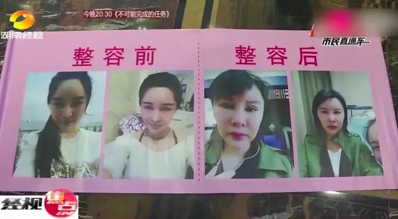 香港名媛整容身亡，背后黑幕被深扒：暗访视频曝光后，我看到了最恐怖的一幕（组图） - 38