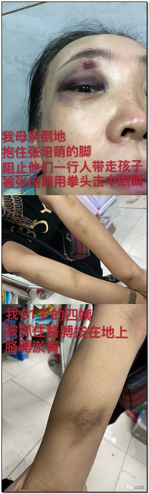 哭声凄厉！中国短跑传奇名将张培萌疑似残忍家暴妻子引发众怒（视频/组图） - 52