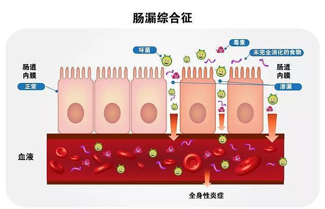 注意！张文宏警示：米面主食吃的太多，很难活到90岁（视频/组图） - 8