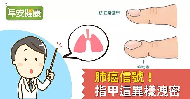 华人指甲呈这个形状，立马去医院，可能是致死率极高的癌症（组图） - 7
