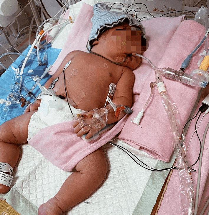 奇迹！心跳和呼吸一度停止，新加坡早产女婴终于抢救成功（组图） - 5