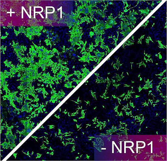图中绿色的是被新冠病毒感染的人类细胞，在没有宿主因子NPR1的辅助时，病毒的感染性大大降低